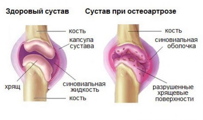 Артепарон цена