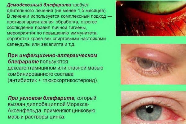 Воспаление века глаза народные средства