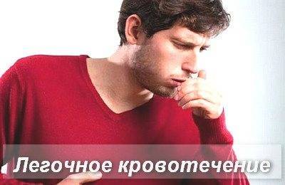 Кровохарканье: причины, диагностика и лечение — симптомы