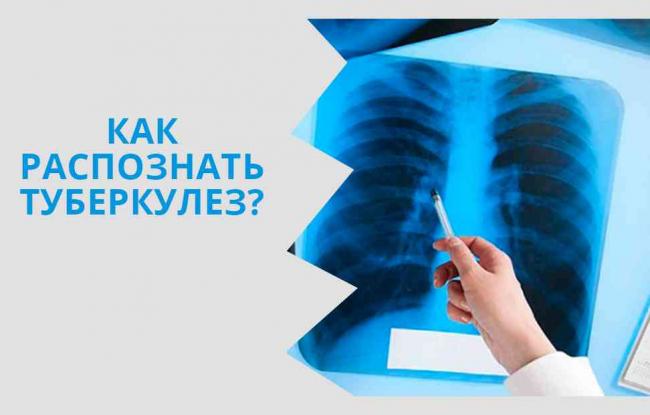 Как обнаружить туберкулез симптомы первые признаки.
