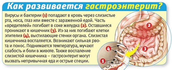 Гастроэнтерит: причины, симптомы и лечение