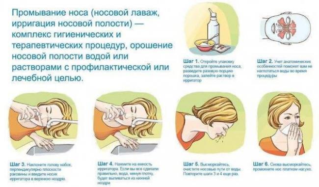 Чем промывать нос при гайморите в домашних условиях: рецепты растворов