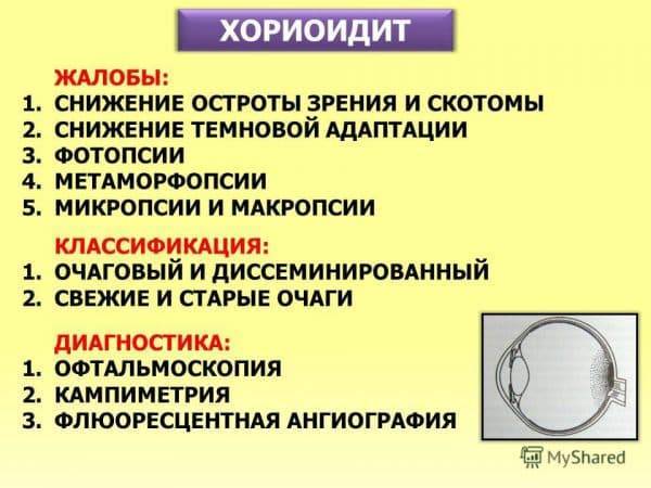 В глазу плавает черная паутина что это и как избавиться