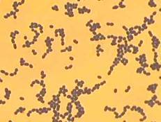 Enterococcus faecalis (энтерококк фекальный) в мазке у женщин