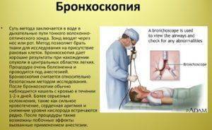 Признаки пневмонии у ребенка без температуры но с кашлем симптомы