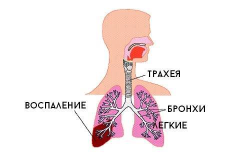 Кашель у ребенка после физкультуры