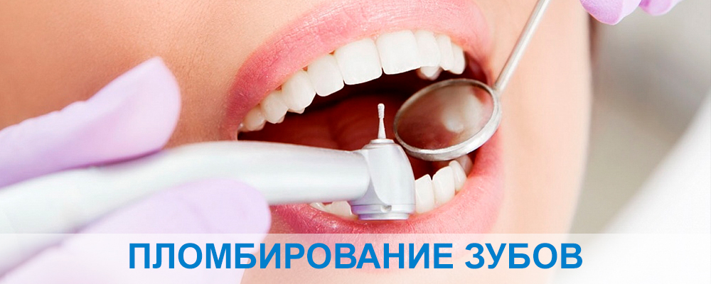 Пломбирование зубов