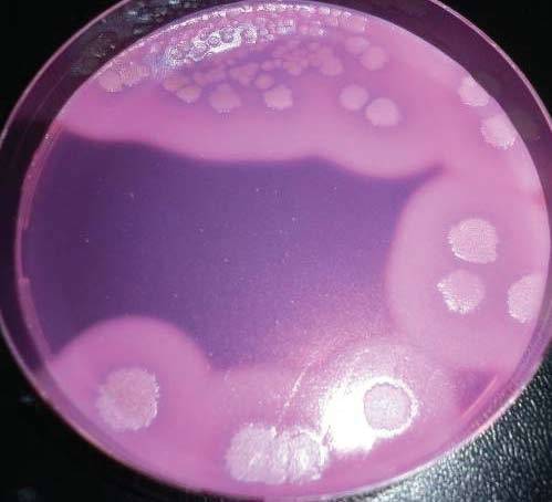 Bacillus subtilis: основные свойства, характеристики, особенности
