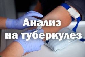 Где можно сделать пцр на туберкулез
