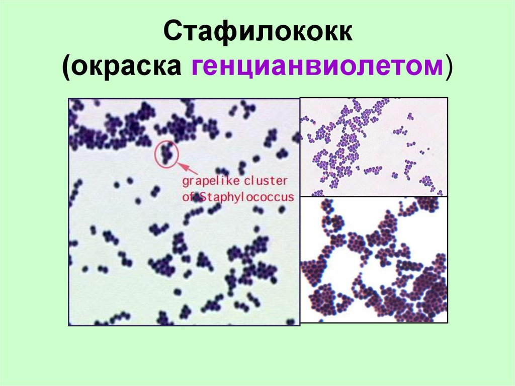 Генцианвилет : инструкция по применению