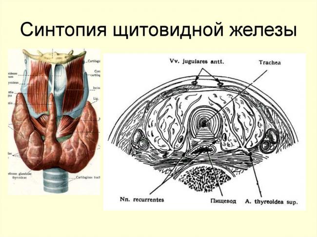 Лечение гиперплазии щитовидной железы 1, 2, 3 степени, признаки заболевания