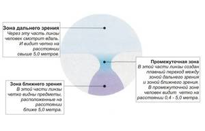 Что такое пересчёт астигматических линз и зачем он нужен