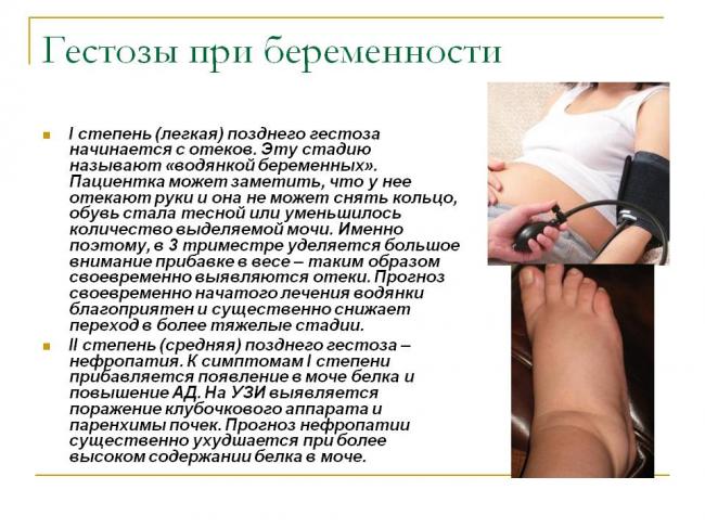 Токсикоз и удачная беременность