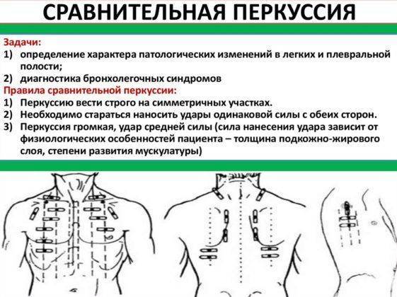 Признаки пневмонии у ребенка без температуры но с кашлем симптомы