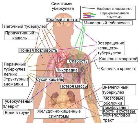 Последствия после перенесенного туберкулеза легких