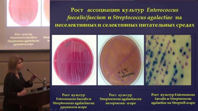 Энтерококки — симптомы, причины, виды и лечение энтерококковой инфекции