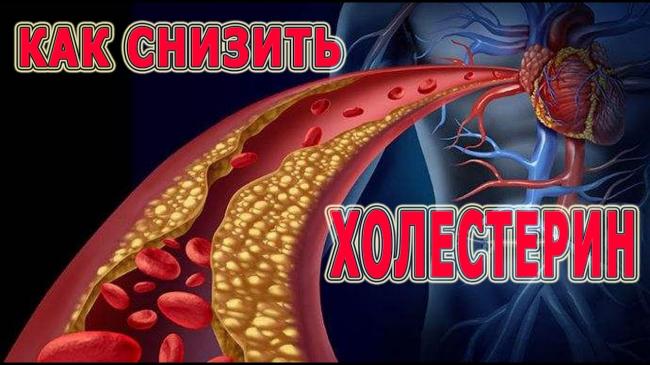 Холемин — средство от холестерина или очередной развод?