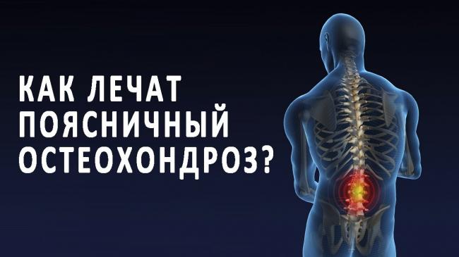 Что собой представляет и характерные симптомы спондилита позвоночника