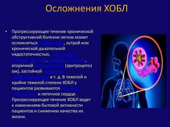 Хобл – что это такое, как лечится? хроническая обструктивная болезнь легких – симптомы, лечение, продолжительность жизни