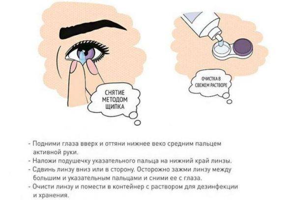 Может ли потеряться линза в глазу: как понять, что линза вывернута