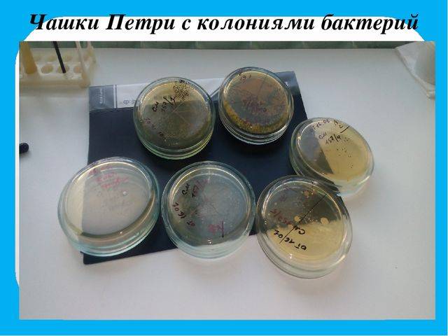 Болезни грязных рук: инфекции и гигиена