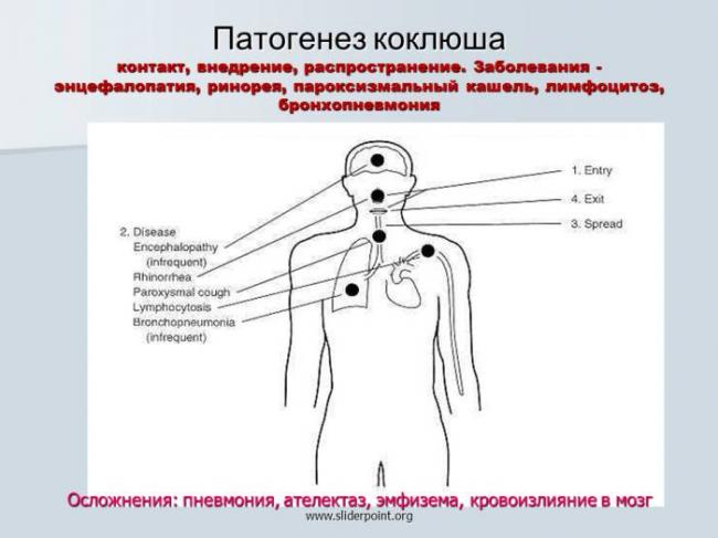 Лимфоцитоз в крови: причины, симптомы, методы лечения