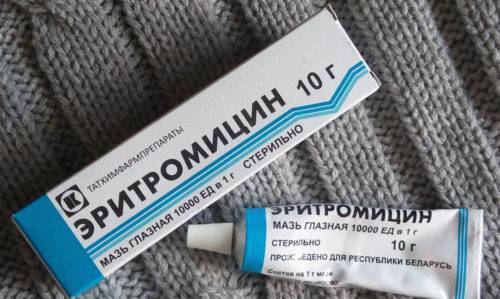 Как правильно лечить ячмень во время беременности