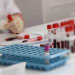 Холестаз при беременности: симптомы и лечение застоя желчи