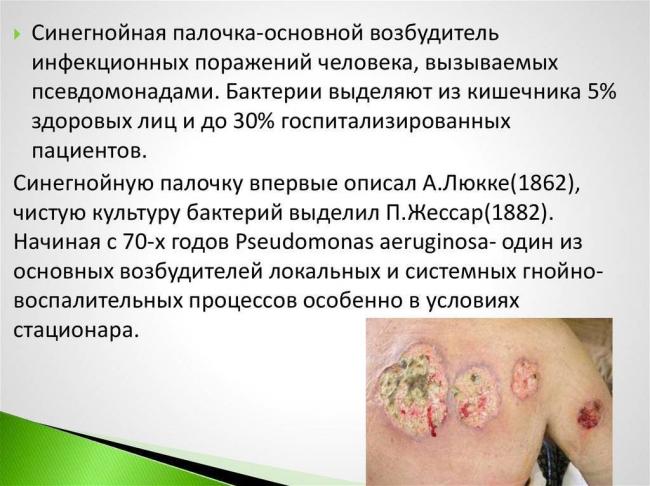 Синегнойная палочка