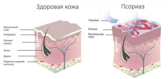 Красные точки на ладонях