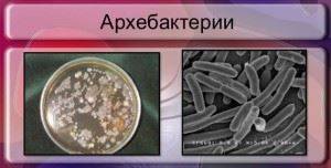 Классификация и ультраструктура, химический состав спирохет.методы обнаружения и роль в патологии человека