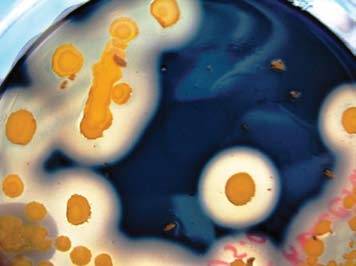 Bacillus cereus у детей - симптомы болезни, профилактика и лечение bacillus cereus у детей, причины заболевания и его диагностика на eurolab