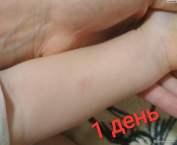 Доктор комаровский о пробе манту