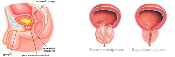 Урологический сбор во время беременности