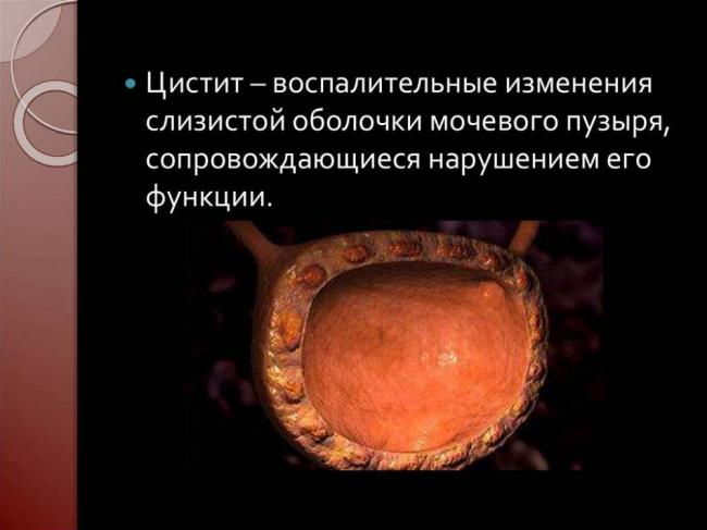 Описание препарата НИТРОКСОЛИН NITROXOLINE