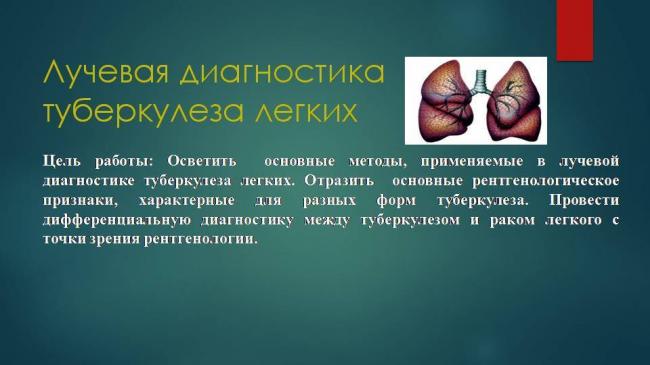 Отличие туберкулеза и рака легких по симптомам, анализам и рентгенологическому снимку