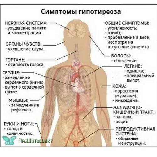 Недостаточность щитовидной железы (гипотиреоз), симптомы, лечение