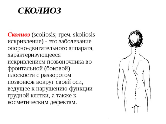 Лфк при сколиозе 1 и 2 степени: комплекс упражнений. рекомендации врача лфк