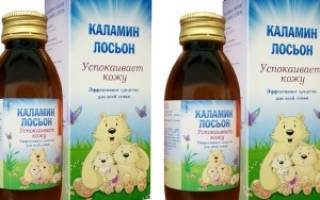 Как правильно применять лосьон каламин при ветрянке и какие есть аналоги