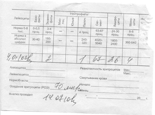 Анализ крови у ребенка при бактериальной инфекции