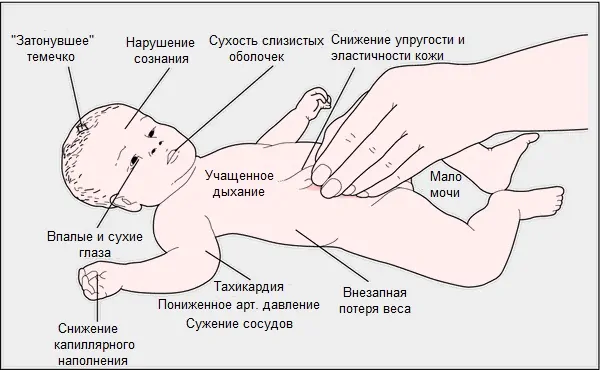 Глава 37 дегидратация