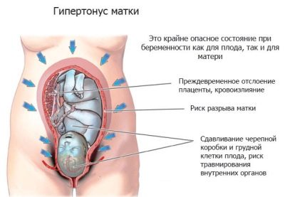 Свечи с папаверином????