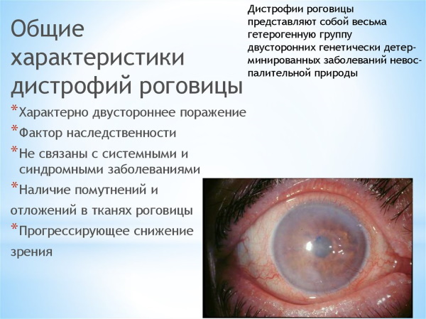 Тауфон табс лютеин. инструкция по применению, цена, отзывы
