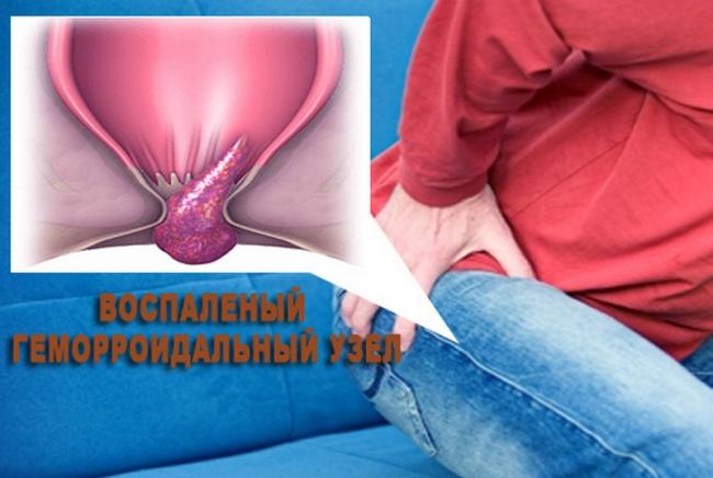 Что нужно знать о мази постеризан