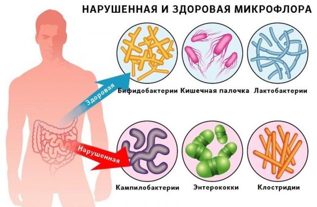 Симптомы вирусного гастроэнтерита — что это и как лечить