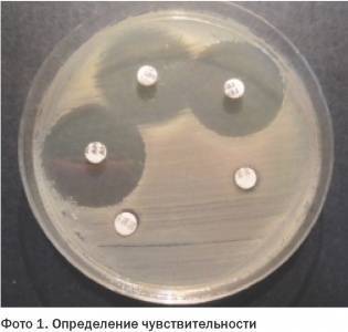 Проба на чувствительность к антибиотикам