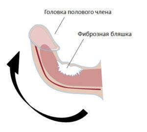 Коллализин