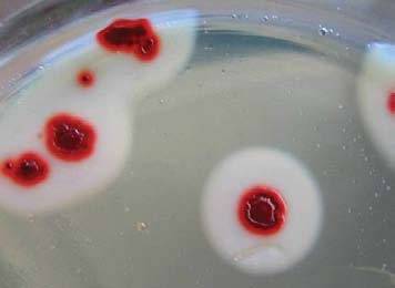 Bacillus cereus у детей