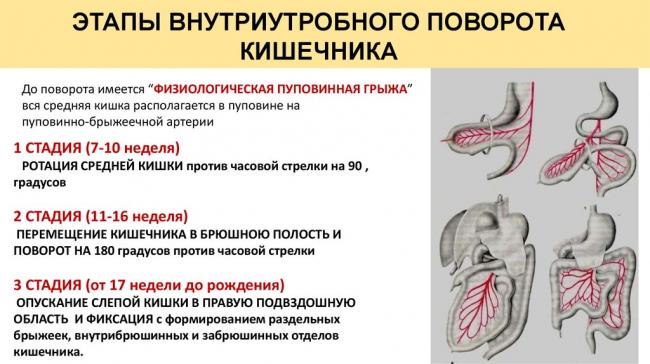 Диета после операции по непроходимости кишечника