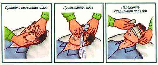 Обезболивающие капли для глаз при травме, повреждении роговицы, препараты с противовоспалительным, заживляющим эффектом, для анестезии: список, инструкции, стоимость